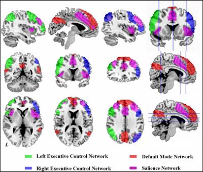 Methadone maintenance treatment alters couplings of default mode and salience networks in individuals with heroin use disorder: A longitudinal self-controlled resting-state fMRI study